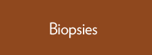Biopsies